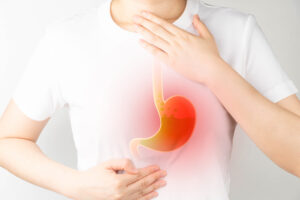 A legal team can tell you more about the GERD, heartburn, and acid reflux defense for DUI charges.